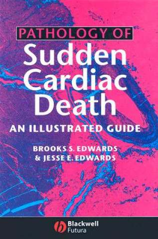 Carte Pathology of Sudden Cardiac Death - An Illustrated  Guide B. Edwards