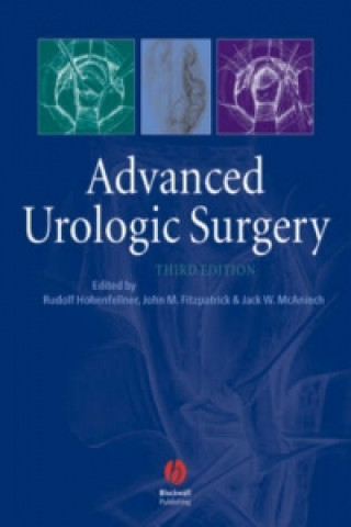 Kniha Advanced Urologic Surgery 3e Rudolp Hohenfellner