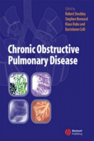 Knjiga Chronic Obstructive Pulmonary Disease Robert A. Stockley