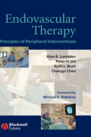 Book Endovascular Therapy Alan Lumsden