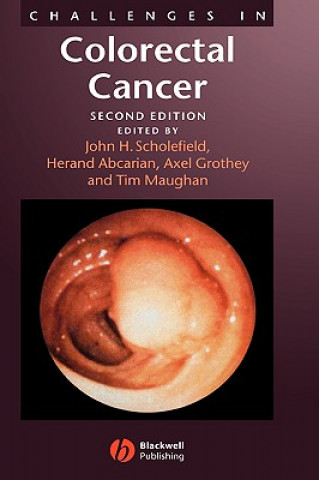 Buch Challenges in Colorectal Cancer 2e Scholefield