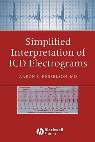 Kniha Simplified Interpretation of ICD Electrograms Aaron B. Hesselson