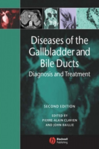 Carte Diseases of the Gallbladder and Bile Ducts Pierre-Alain Clavien