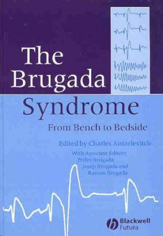 Book Brugada Syndrome - From Bench to Bedside Charles Antzelevitch