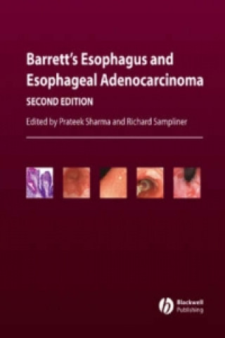 Książka Barrett's Esophagus and Esophageal Adenocarcinoma Prateek Sharma