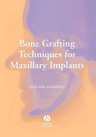 Könyv Bone Grafting Techniques for Maxillary Implants Karl-Erik Kahnberg