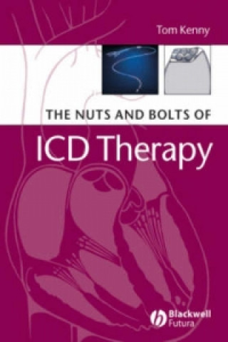 Knjiga Nuts and Bolts of ICD Therapy Tom Kenny