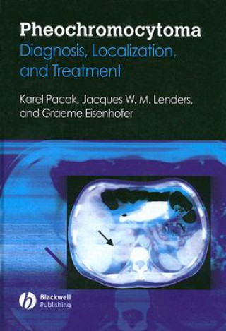 Libro Pheochromocytoma Karel Pacak