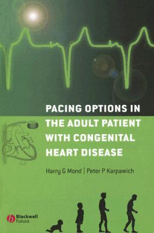 Kniha Pacing Options in the Adult Patient with Congenital Heart Disease Harry G. Mond