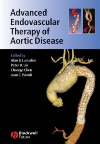Könyv Advanced Endovascular Therapy of Aortic Disease Alan B. Lumsden