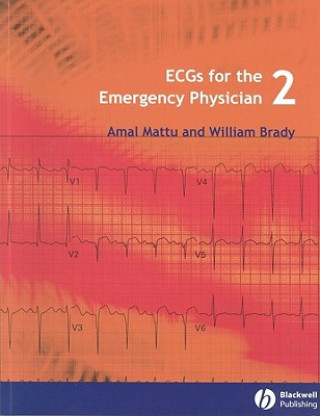Könyv ECGs for the Emergency Physician 2e Amal Mattu