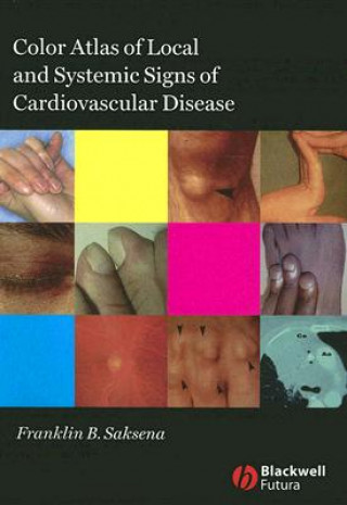 Книга Colour Atlas of Local and Systemic Signs of Cardiovascular Disease Franklin B. Saksena