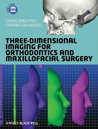 Carte Three-Dimensional Imaging for Orthodontics and Maxillofacial Surgery Chung How Kau