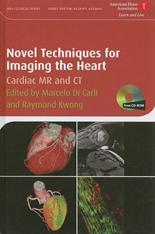 Carte Novel Techniques for Imaging the Heart - Cardiac MR and CT Marcelo F. Di Carli
