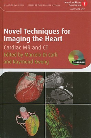 Livre Novel Techniques for Imaging the Heart - Cardiac MR and CT Marcelo F. Di Carli