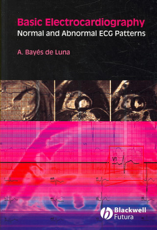 Knjiga Basic Electrocardiography - Normal and Abnormal ECG Patterns Antonio Bayes de Luna
