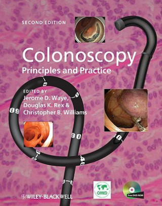 Könyv Colonoscopy Jerome D. Waye