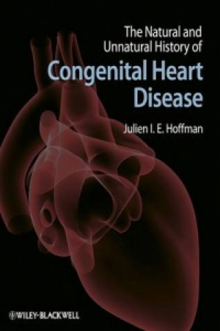 Könyv Natural and Unnatural History of Congenital Heart Disease 