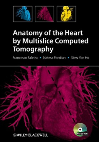 Carte Anatomy of the Heart by Multislice Computed Tomography Francesco Fulvio Faletra