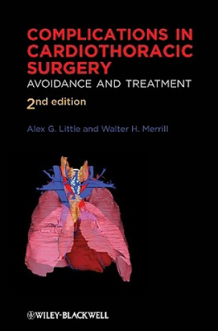 Kniha Complications in Cardiothoracic Surgery - Avoidance and Treatment 2e Alex G. Little Md