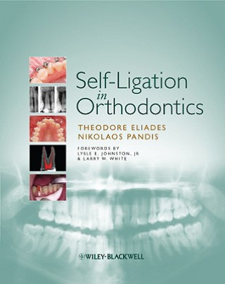 Kniha Self-Ligation in Orthodontics Theodore Eliades
