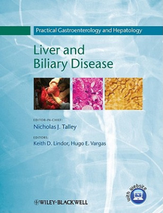 Kniha Practical Gastroenterology and Hepatology - V3 Liver and Biliary Disease Keith D. Lindor