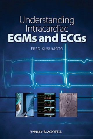 Kniha Understanding Intracardiac EGMs and ECGs Fred Kusumoto