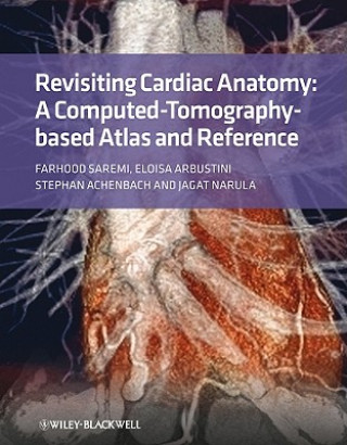 Книга Revisiting Cardiac Anatomy - A Computed-Tomography - Based Atlas and Reference Farhood Saremi