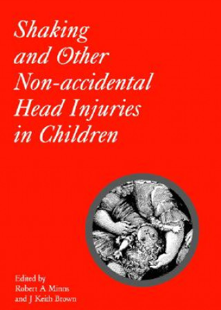 Carte Shaking and Other Non-Accidental Head Injuries in Children Robert A. Minns