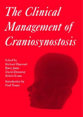 Kniha Clinical Management of Craniosynostosis Richard Hayward