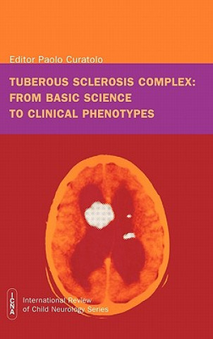 Knjiga Tuberous Sclerosis Complex - From Basic Science to  Clinical Phenotypes International Review of Child  Neurology Series Paolo Curatolo