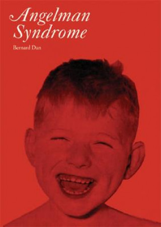 Книга Angelman Syndrome Bernard Dan
