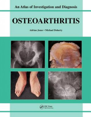 Buch Oesteoarthritis Adrian Jones