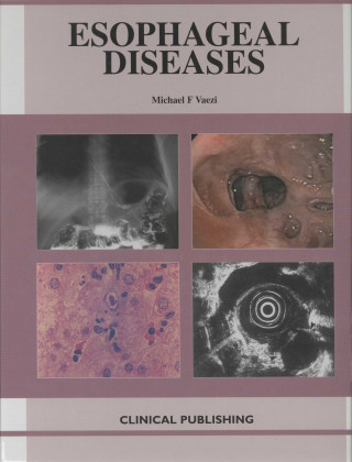 Buch Esophageal Diseases M. Vaizi