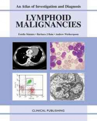 Kniha Lymphoid Malignancies Barbara J. Bain