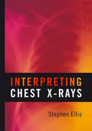 Könyv Interpreting Chest X-Rays Stephen G. Ellis