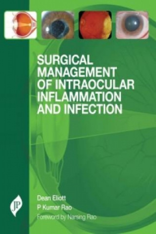 Kniha Surgical Management of Intraocular Inflammation and Infection Dean Eliot