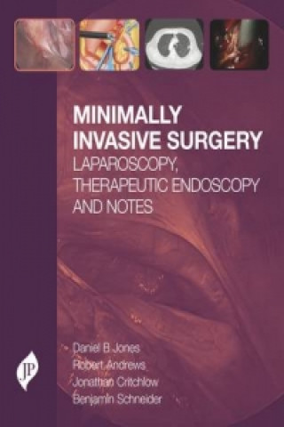 Carte Minimally Invasive Surgery Benjamin E. Schneider