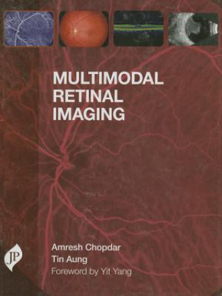 Könyv Multimodal Retinal Imaging Amresh Chopdar