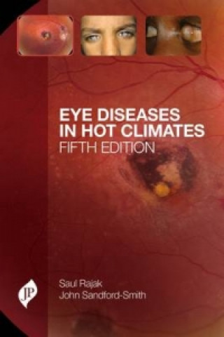 Livre Eye Diseases in Hot Climates Saul N. Rajak