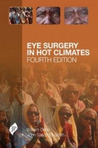 Kniha Eye Surgery in Hot Climates William Dean
