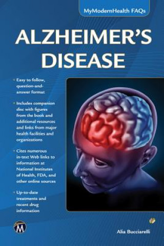 Könyv Alzheimer's Disease Alla Bucclarelli