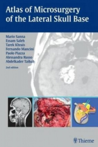 Könyv Atlas of Microsurgery of the Lateral Skull Base Mario Sanna