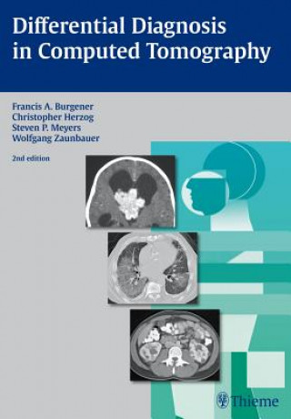 Carte Differential Diagnosis in Computed Tomography Francis A. Burgener