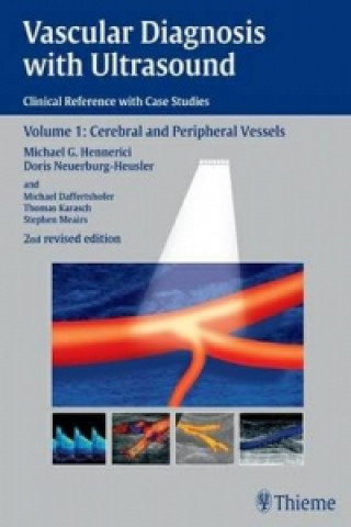 Książka Vascular Diagnosis with Ultrasound Michael G. Hennerici