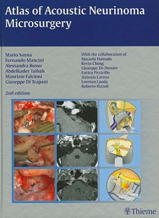 Книга Atlas of Acoustic Neurinoma Microsurgery Mario Sanna