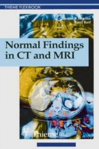 Kniha Normal Findings in CT and MRI, A1, print Emil Reif