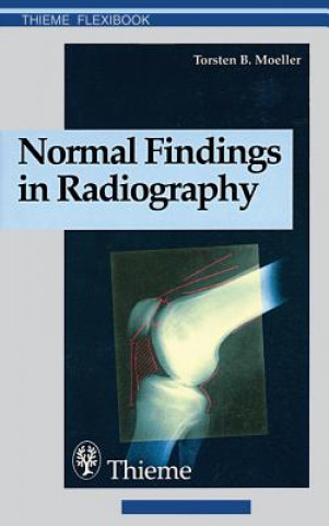 Könyv Normal Findings in Radiography Torsten B. Moller