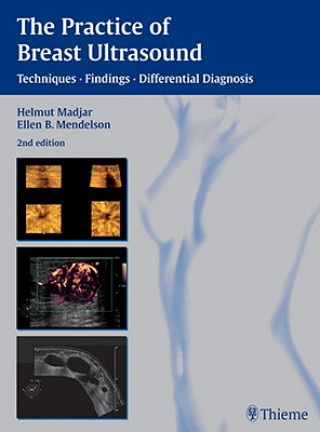 Könyv Practice of Breast Ultrasound Helmut Madjar