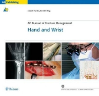 Kniha AO Manual of Fracture Management - Hand and Wrist Jesse B. Jupiter